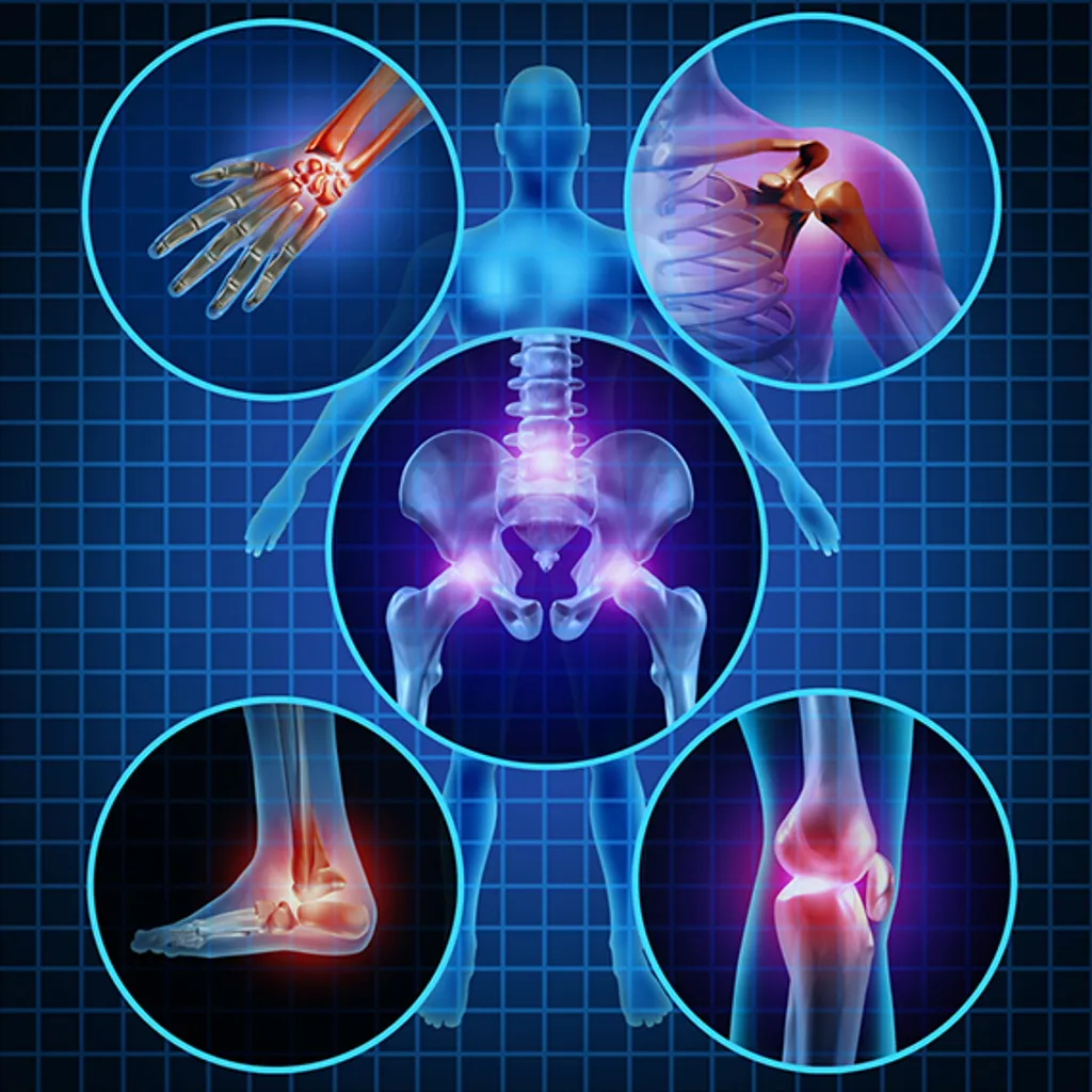 Arthritis/Joint Pain